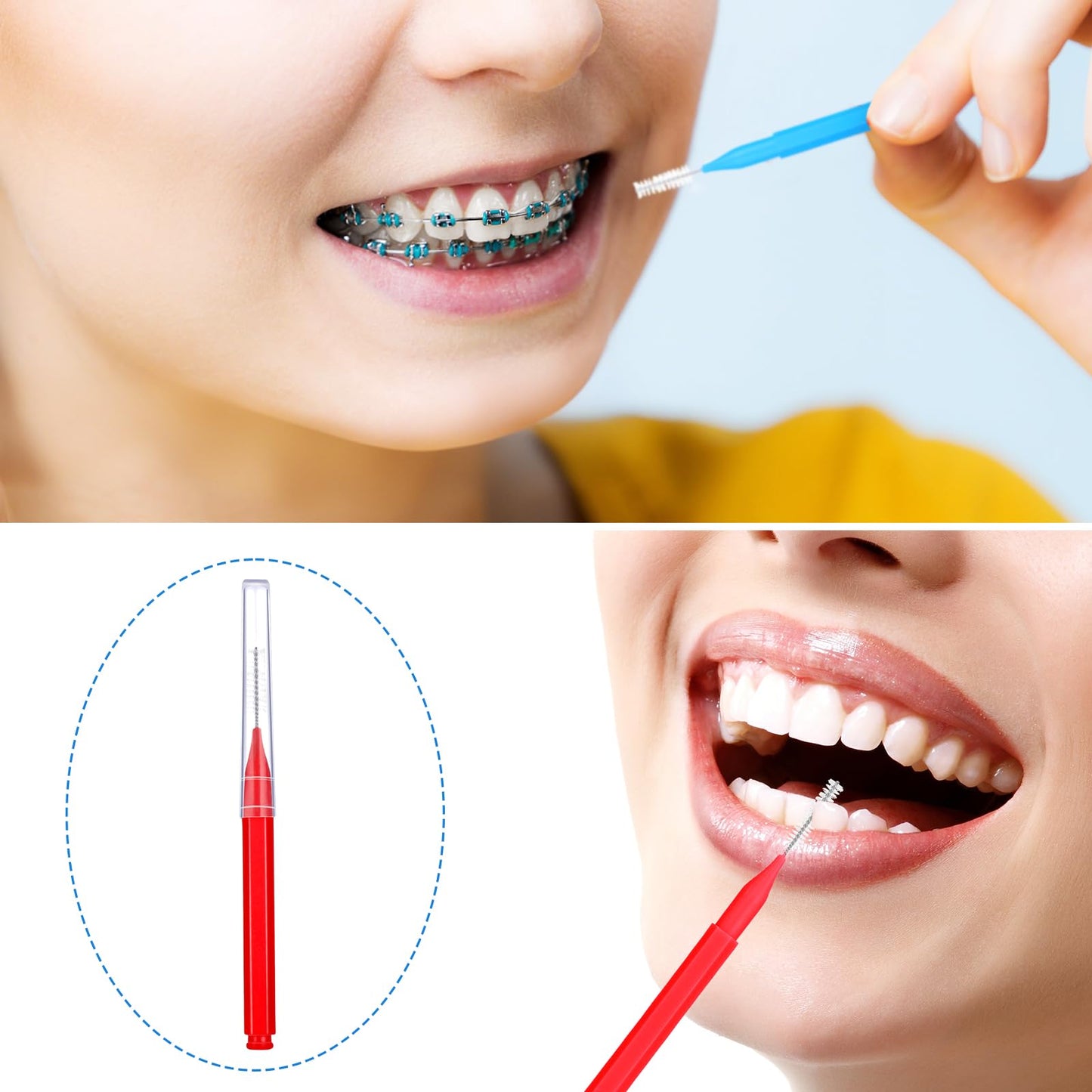 Patelai 100 Pieces Interdental Brushes – Braces Brush for Cleaner Teeth (Blue, Red, Suitable Size)