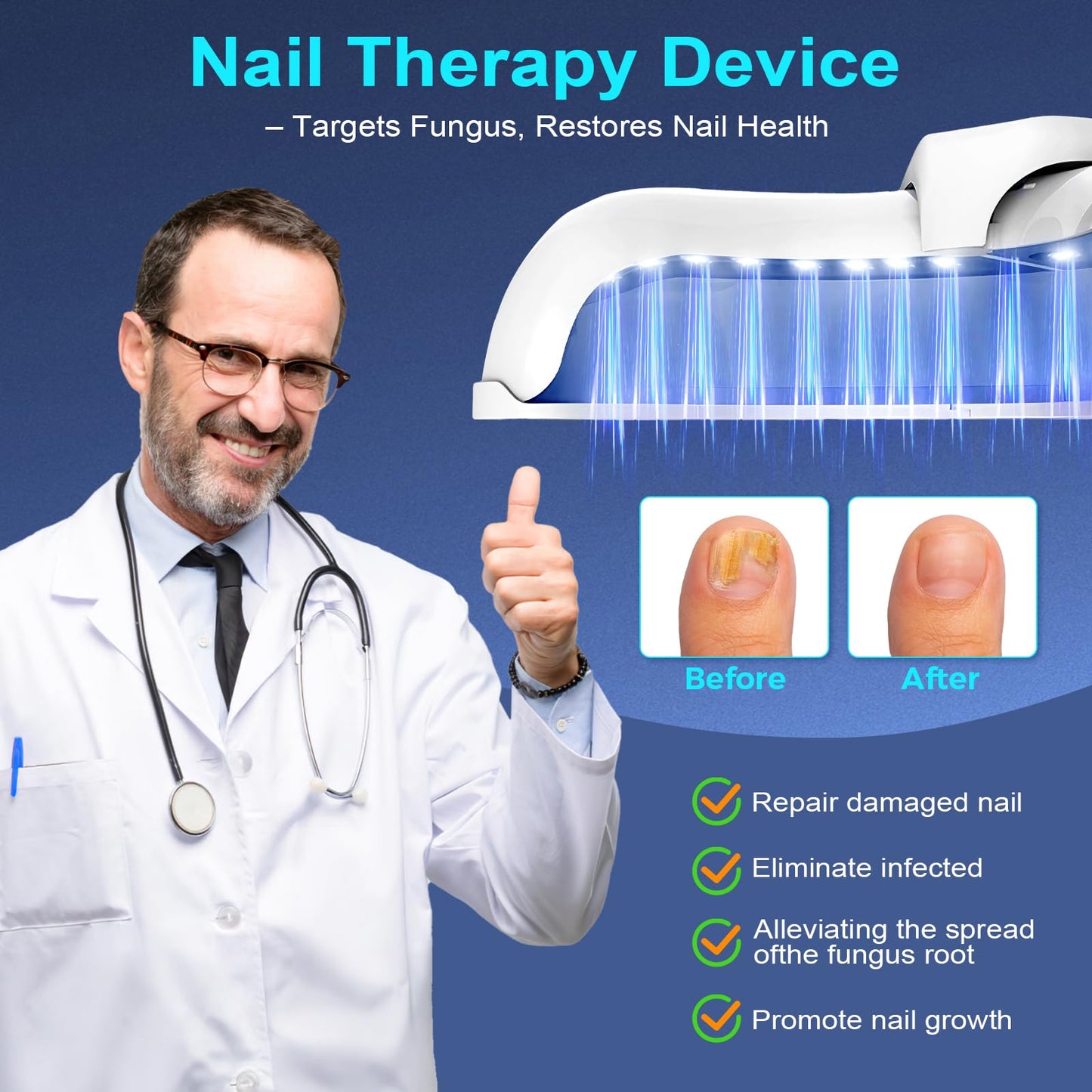 XiNanc Nail Fungus Laser Treatment LED Light Device | Rechargeable Toenail Light Therapy