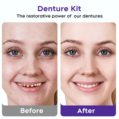 Denture DIY Full Set: Top & Bottom Fake Teeth Kit | Improve Your Smile 0806-1