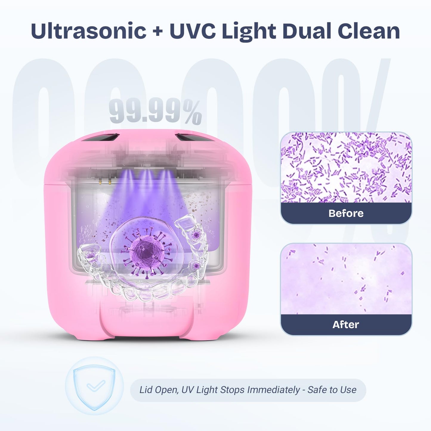 2025 Ultrasonic Retainer Cleaner – 45KHz 25W with Drying, UVC Light, Removable Tank | Pink