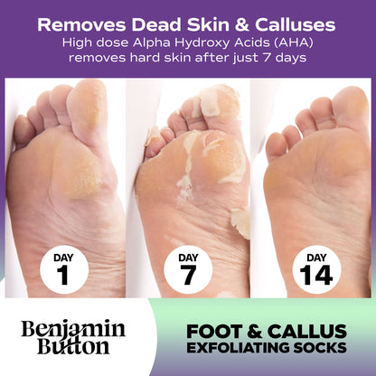 Exfoliating Foot Peel Mask – AHA Foot Peeling Mask – 5 Pack