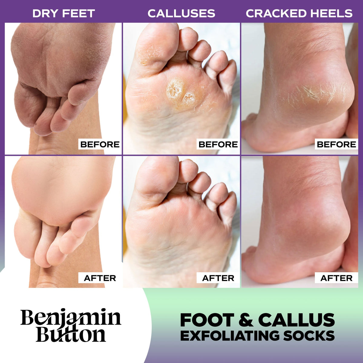 Advanced Exfoliating Foot Mask Single Benjamin Button