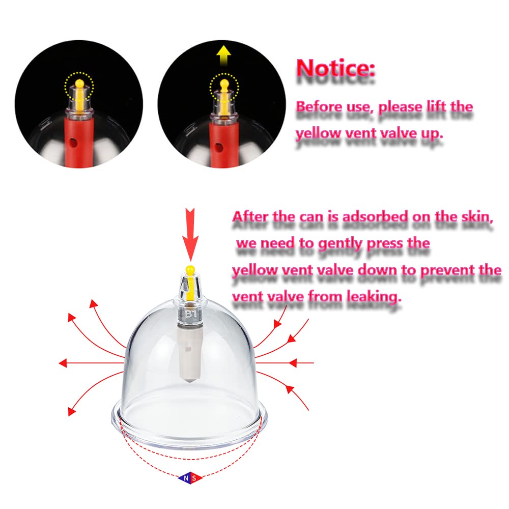 26 Cupping Cups Biomagnetic Traditional Chinese Therapy Kit | Household Vacuum Cupping Set
