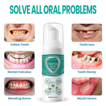 2PCS Foam Toothpaste for Sensitive Teeth - Ultra-fine Mousse, Deep Clean & Stain Removal (2 Pack)