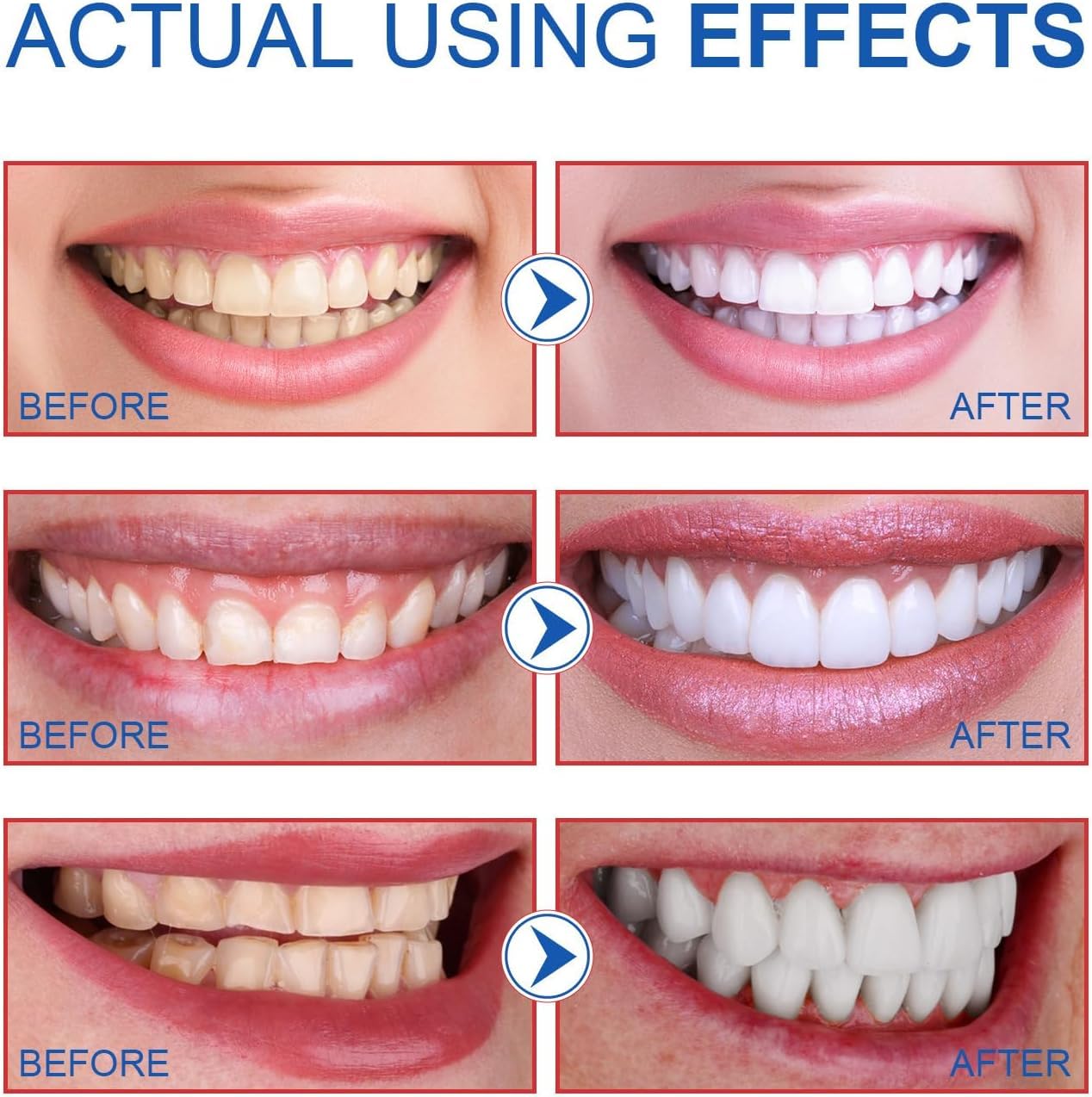 2PCS-SP-6 Whitening Toothpaste – Enamel-Safe, Fluoride-Free, Fresh Mint
