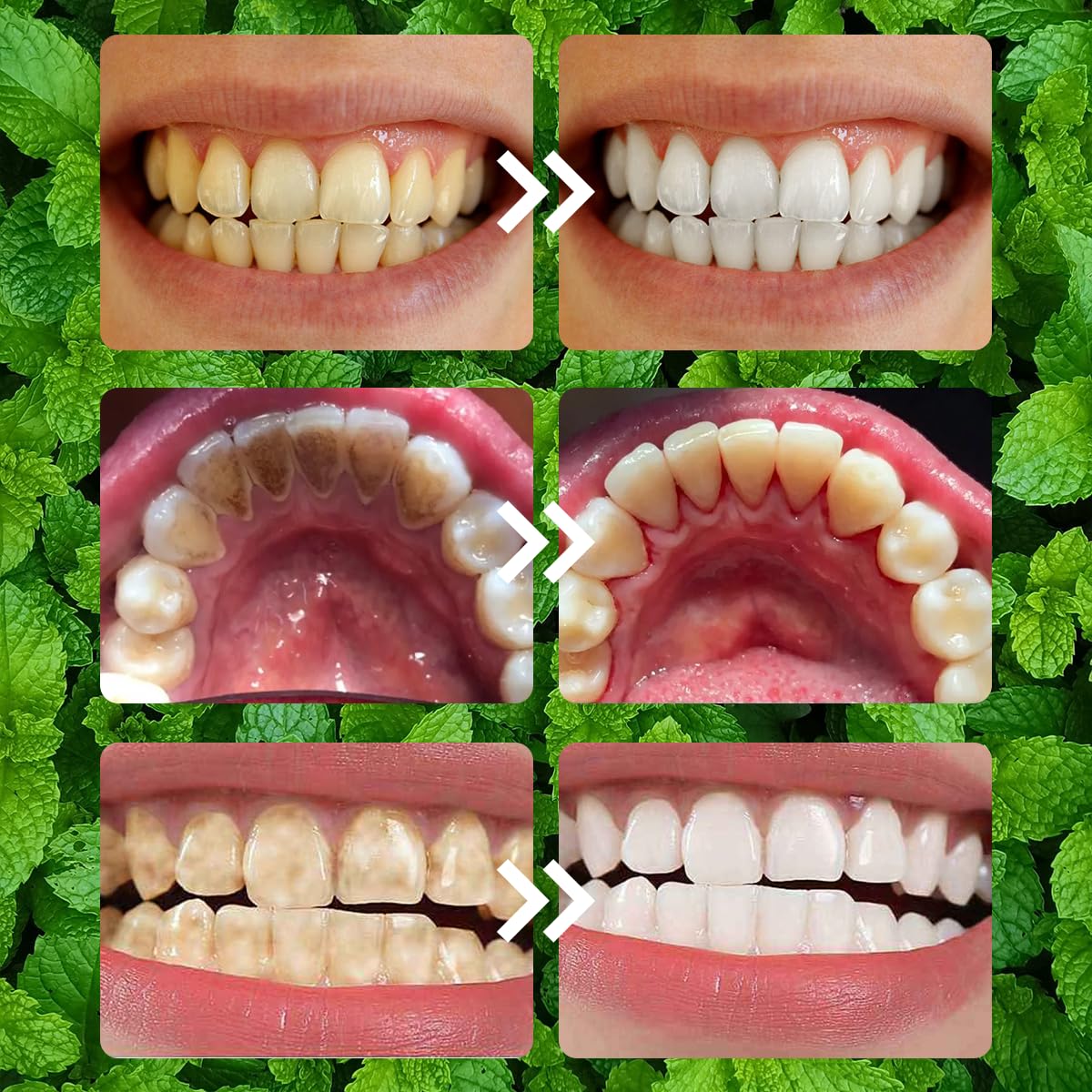 2PCS Teeth Restoration Mineral Powder | Oral & Teeth Care – Strengthen Teeth & Gums