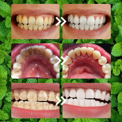 2PCS Teeth Restoration Mineral Powder | Oral & Teeth Care – Strengthen Teeth & Gums