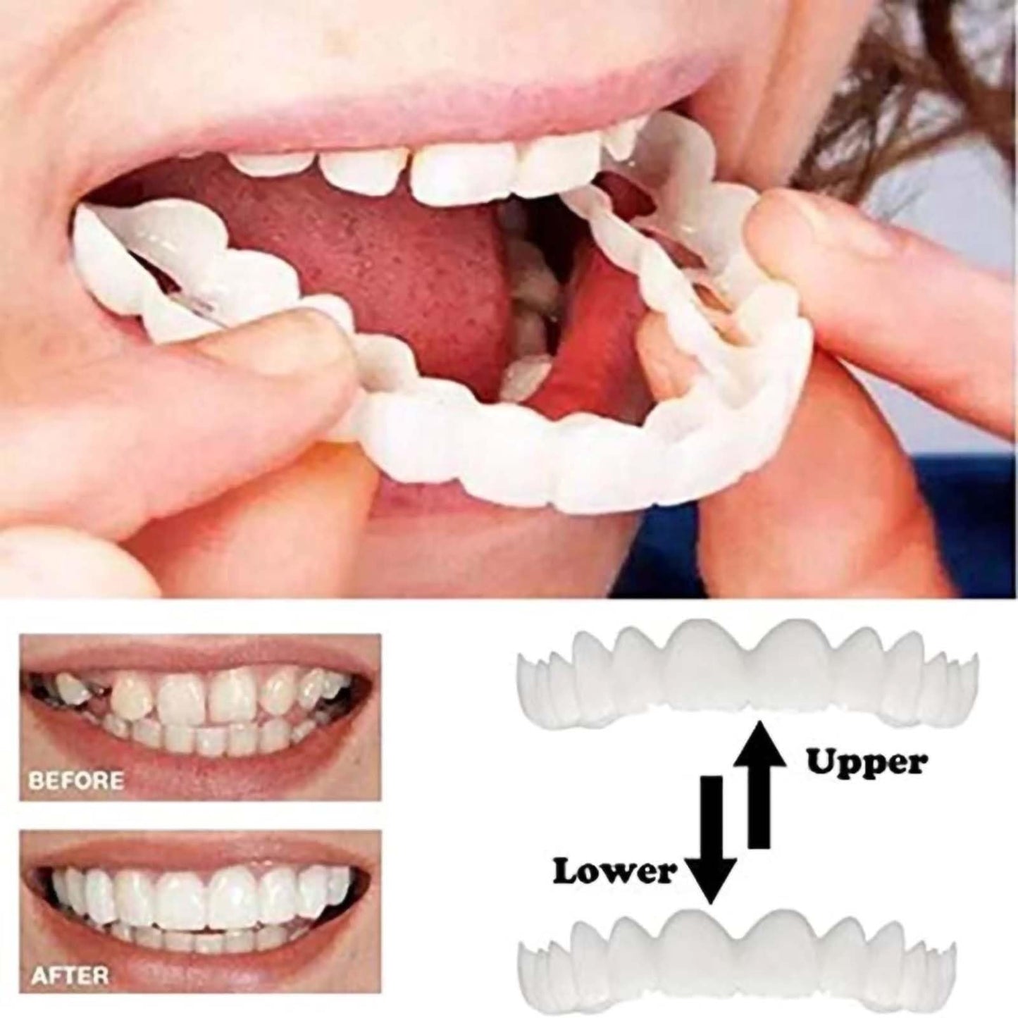 2 Pcs Temporary Adjustable Smile - Natural White, Comfortable for Men & Women