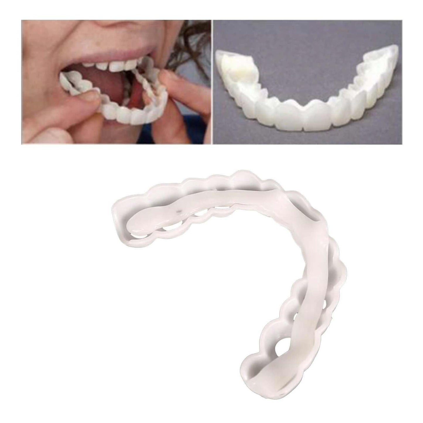2 Pcs Temporary Adjustable Smile - Natural White, Comfortable for Men & Women