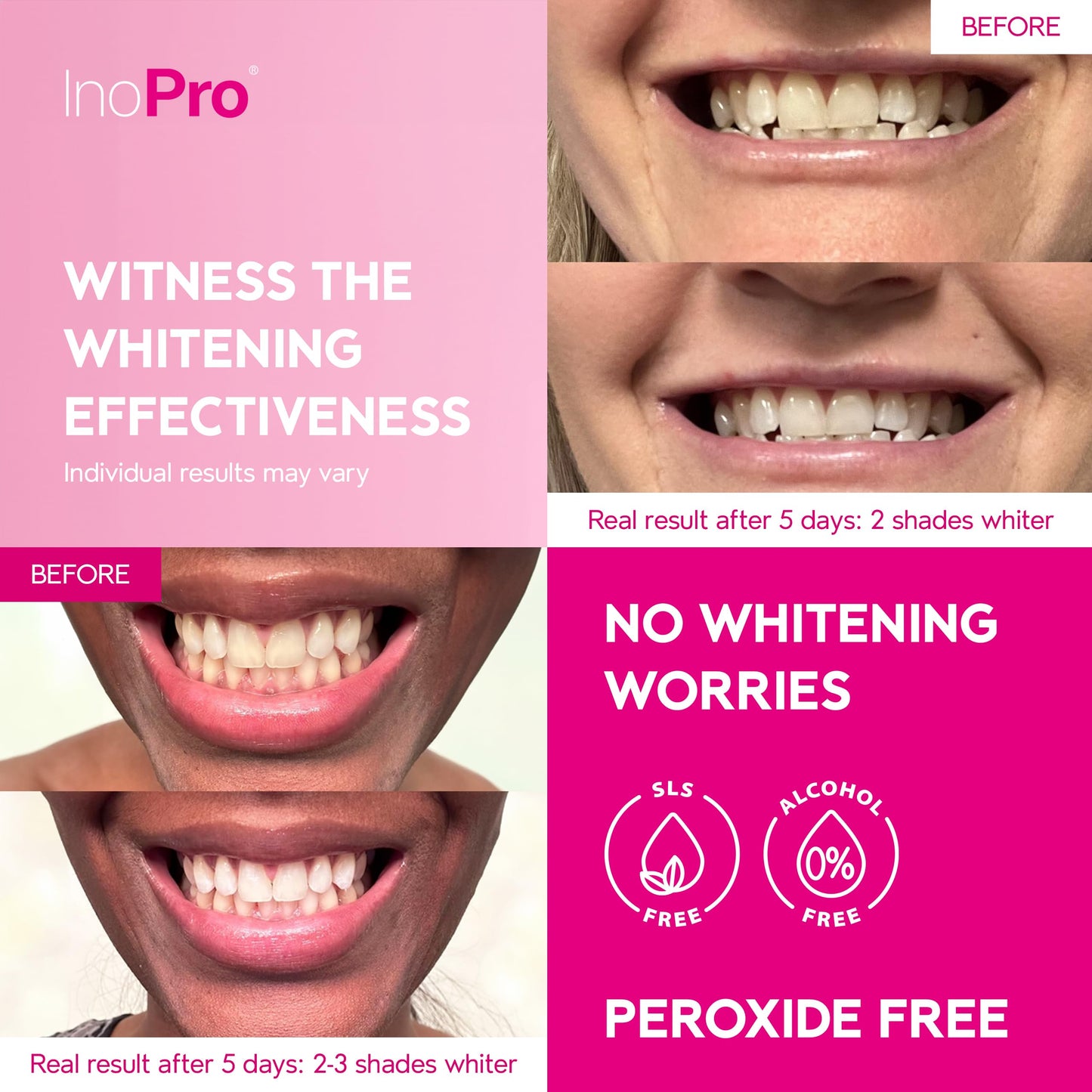 InoPro Teeth Whitening Strips Kit – Enamel Safe, Peroxide-Free, 28 Strips