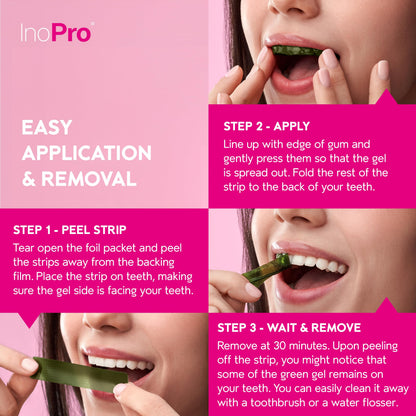 InoPro Teeth Whitening Strips Kit – Enamel Safe, Peroxide-Free, 28 Strips