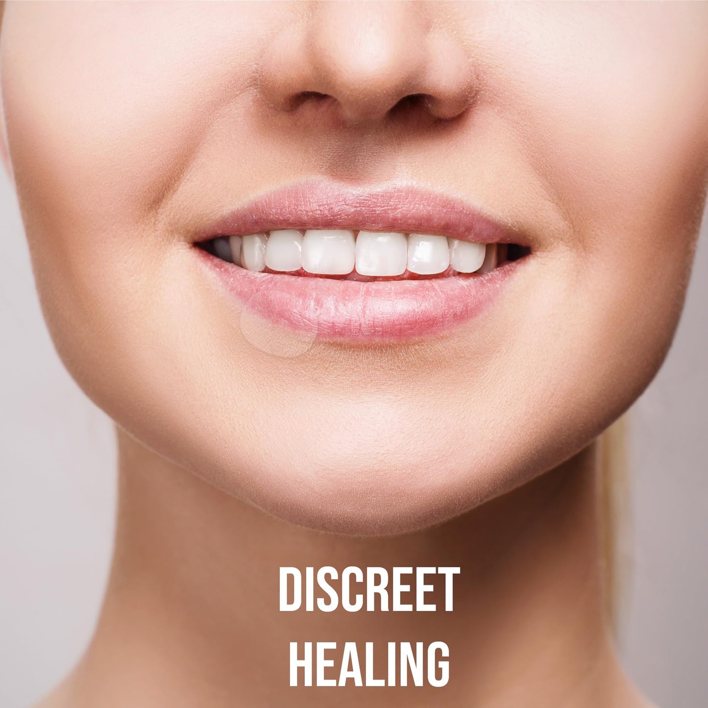 Acculip Cold Sore Patch with Lysine, Zinc & Calendula — Discreet Lip Healing (FSA Eligible)