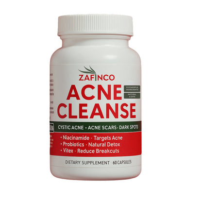 Acne Cleanse Capsules – Vitex Angus-Castus Extract, Niacinamide & Biotin for Teens & Adults | Organic Acne Treatment, 60 Count