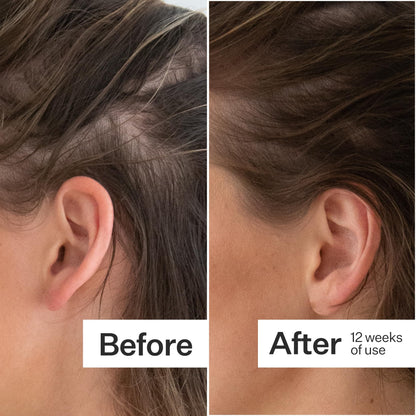 ACT+ ACRE Thick + Full Hair Capsules - Vegan Hair Support, 60ct