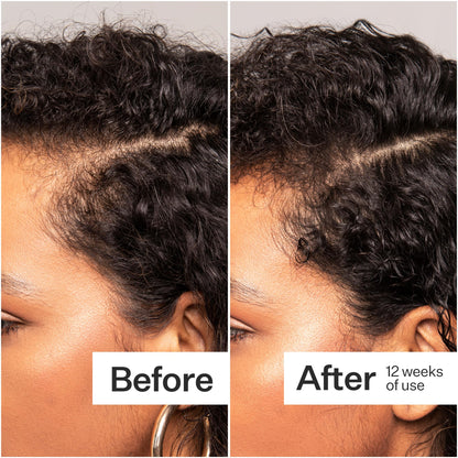 ACT+ ACRE Thick + Full Hair Capsules - Vegan Hair Support, 60ct
