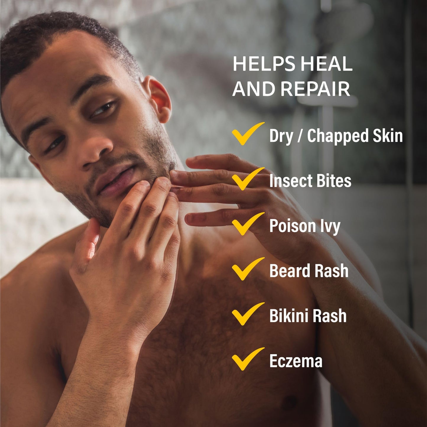 A+D Medicated Rash Ointment 15.2 oz – Soothes Poison Ivy, Eczema, Beard & Bikini Rash, Dry Skin