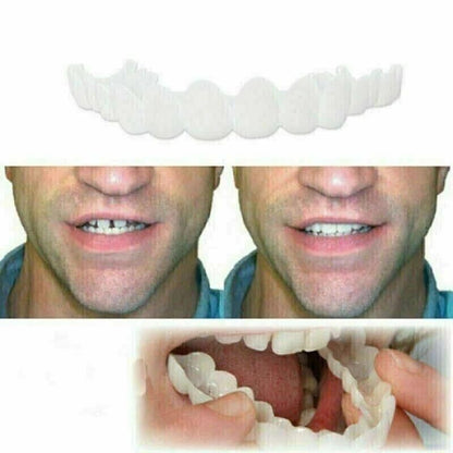 2 Pairs Natural-Looking Temporary Smile Solutions – Top & Bottom Adjustable, Comfortable Experience