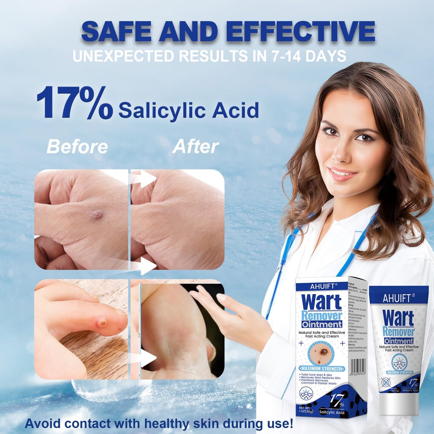 AHUIFT Fast Action Wart Remover Ointment – Maximum Strength Salicylic Acid (XK04)
