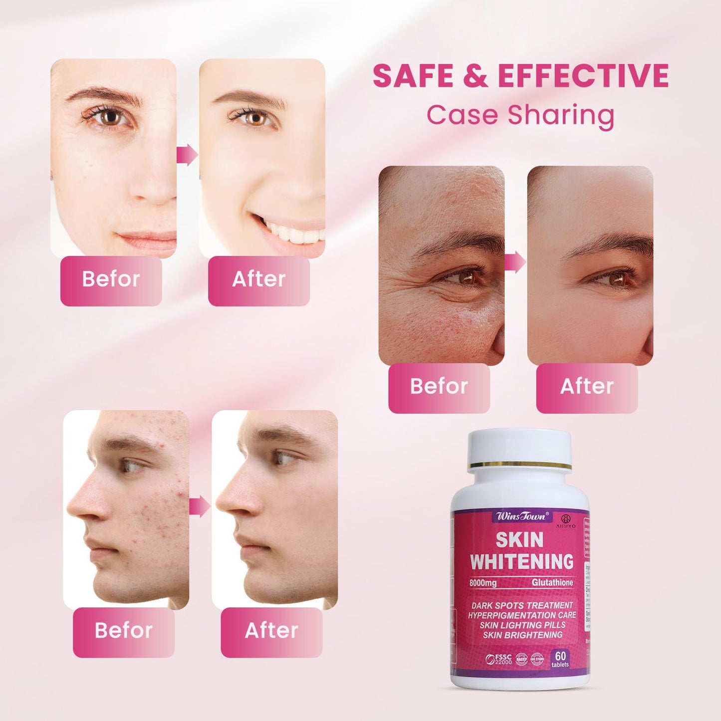 AIHIYO Skin Whitening Pill | 8000mg Glutathione, Dark Spots & Melasma, 60 Tablets