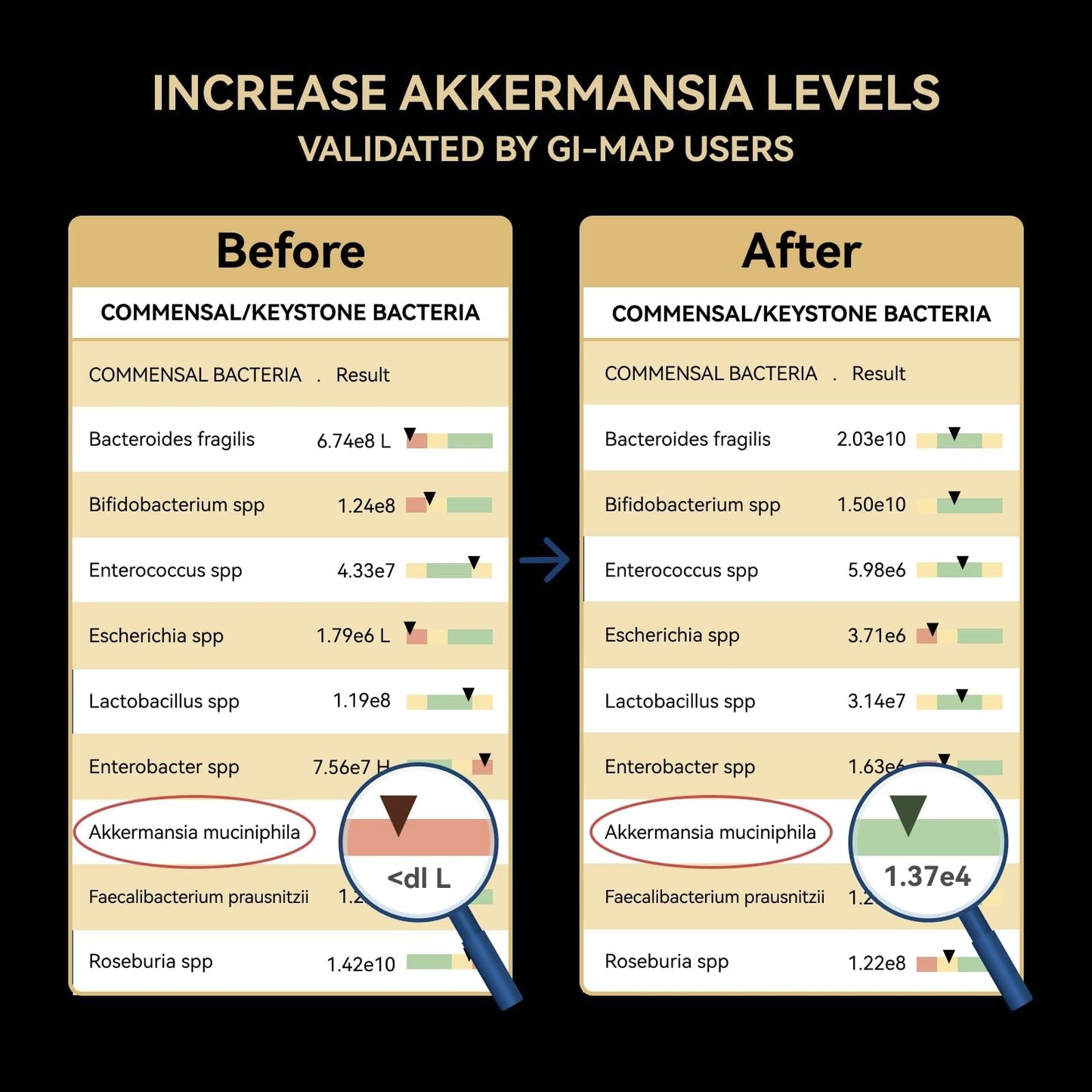 Akkermansia Probiotic – 30B TFU, GLP-1 & Digestion Support