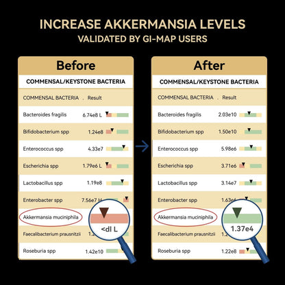 Akkermansia Probiotic – 30B TFU, GLP-1 & Digestion Support