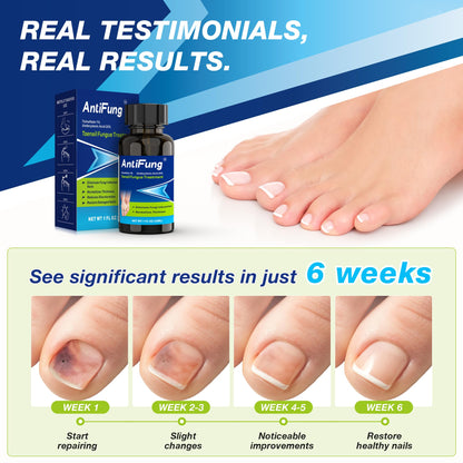 AntiFung Toenail Fungus Treatment Extra Strength – Fast Relief & Nail Repair, 30ml