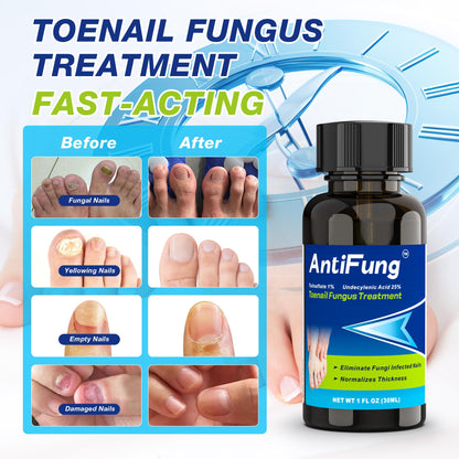 AntiFung Toenail Fungus Treatment Extra Strength – Fast Relief & Nail Repair, 30ml