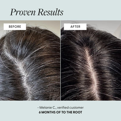 Arey To The Root Hair Serum | Slow Grey Hair & Pigment Preservation (3–6 Months) | Vegan, Oil-Free