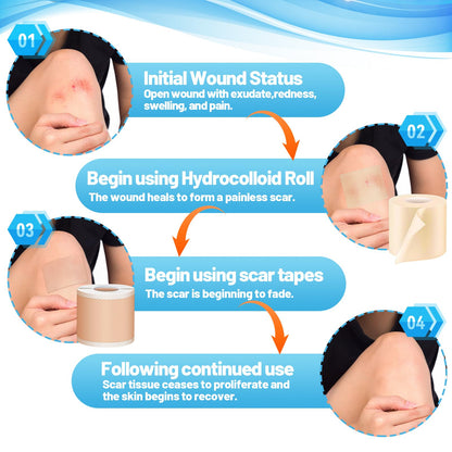 Arme Hydrocolloid Roll & Silicone Scar Tape — Complete Wound Care Duo