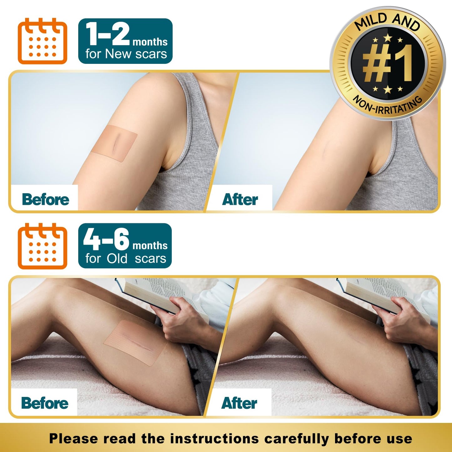 Arme Silicone Scar Sheets – 18-Pack Medical Grade Scar Tape for Surgical, C-Section, and Keloid Scars