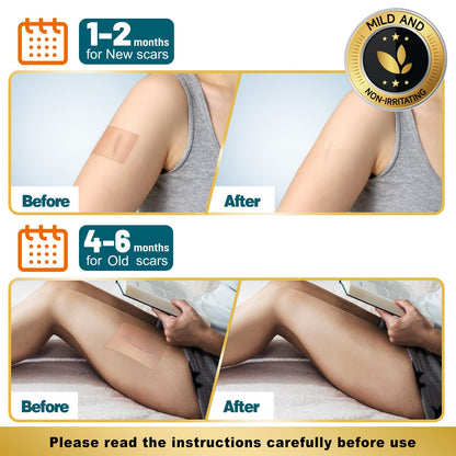 Arme Silicone Scar Tape – 4 Roll Pack (480") Reusable Medical-Grade Scar Sheets