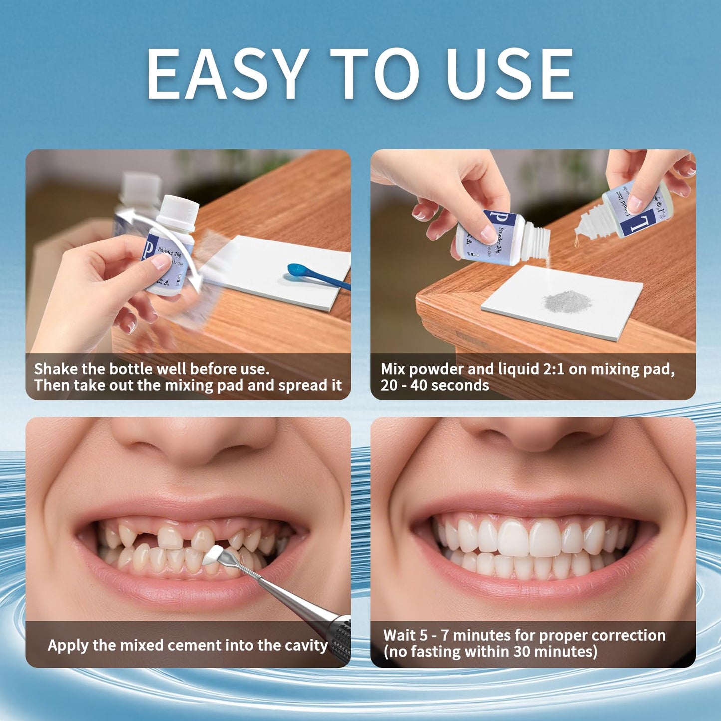 Zinc Oxide Eugenol Cement Dental Care Kit – Temporary Tooth Repair & DIY