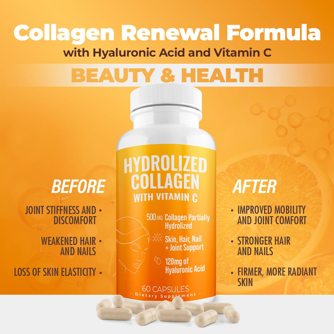 AURA VITAMINS Hydrolyzed Collagen Powder Supplement for Hair, Skin, Nails, Bones & Joints | Grass-Fed Collagen Peptides 200gr