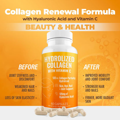 AURA VITAMINS Hydrolyzed Collagen Powder Supplement for Hair, Skin, Nails, Bones & Joints | Grass-Fed Collagen Peptides 200gr