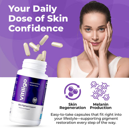 Aura Vitamins Vitiligo Capsules – 60 Count | Pigmentation Support & White Spots