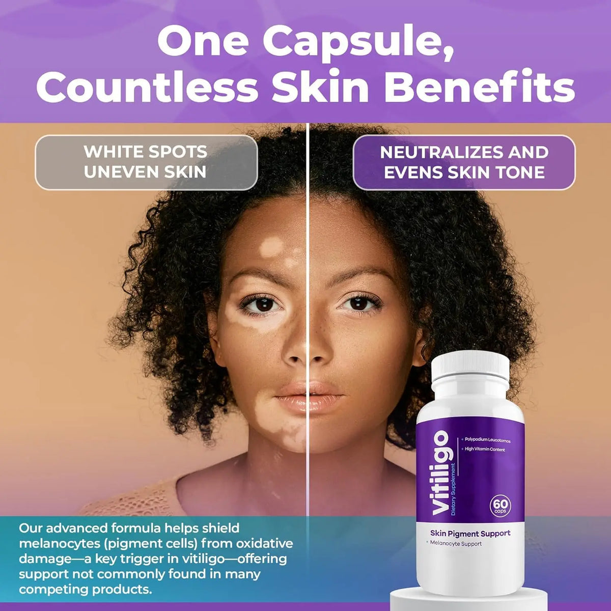 AURA VITAMINS Vitiligo Capsules – 60 Count | 1 Month Supply for Skin Pigmentation Support BritishVita | Premium UK Vitamins & Wellness Supplements