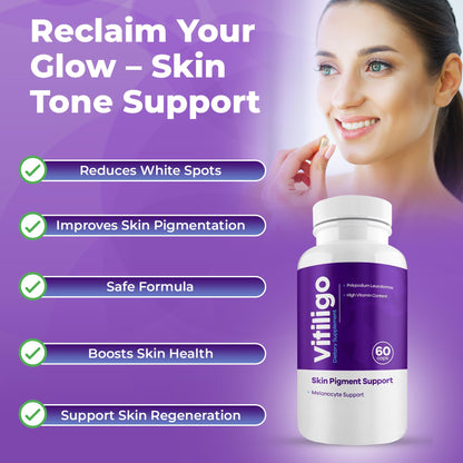 Aura Vitamins Vitiligo Capsules – 60 Count | Pigmentation Support & White Spots