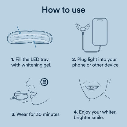 Auraglow Teeth Whitening Kit – Wired LED Accelerator Light, 35% Carbamide Peroxide, 12 Treatments, Whitens Up to 10 Shades in 7 Days