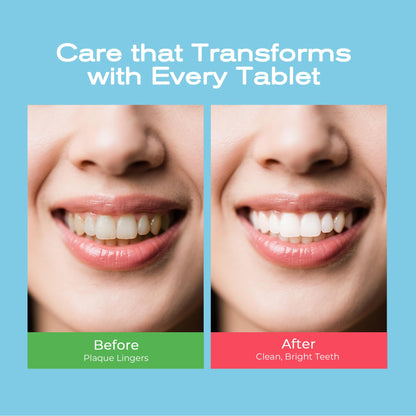 Auranexa Happy Cleaner Toothpaste Tablets – Mixed Pack (Watermelon Mint & Mint Lime) Fluoride-Free Nano Hydroxyapatite