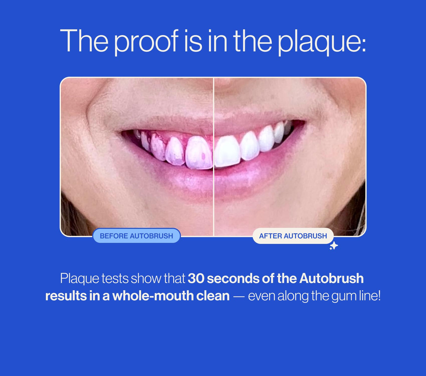 autobrush Kids Electric Toothbrush – ADA-Approved U-Shaped, Clinically Proven 5.1x Cleaning, 30s 360° Coverage (Ages 3-5, Dinosaur)