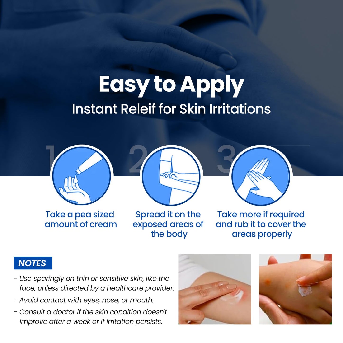 AVEDANA Hydrocortisone Cream – 1 oz Extra Strength Aloe-Infused Itch Relief for Eczema, Rashes & Bites