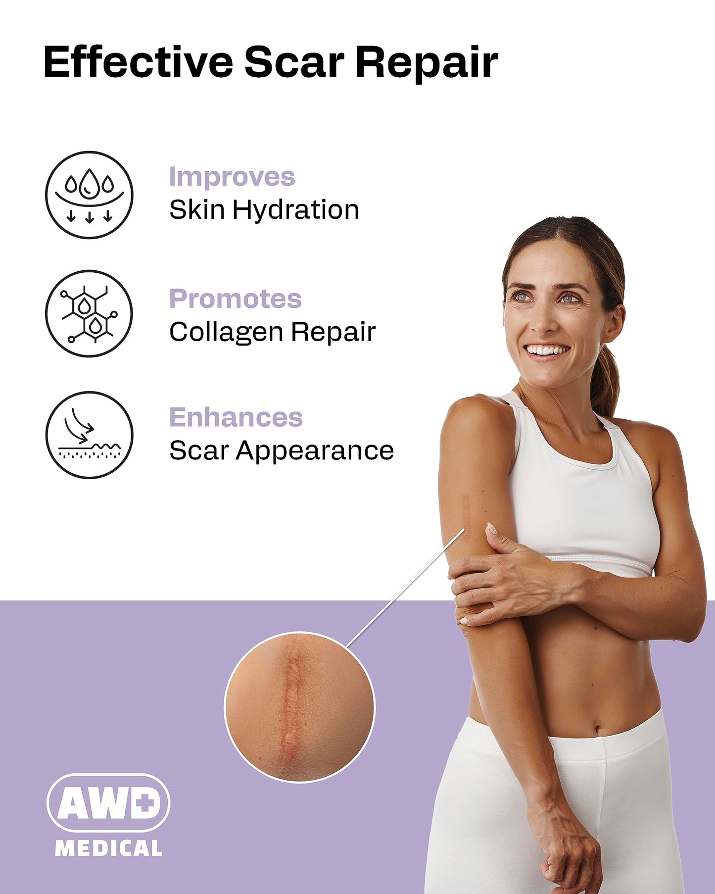 AWD Silicone Scar Tape 3 Pack – 180in Total, Reusable for Surgery & Postpartum | AWD Medical