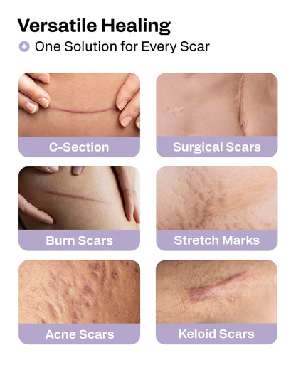 AWD Silicone Scar Tape 3 Pack – 180in Total, Reusable for Surgery & Postpartum | AWD Medical