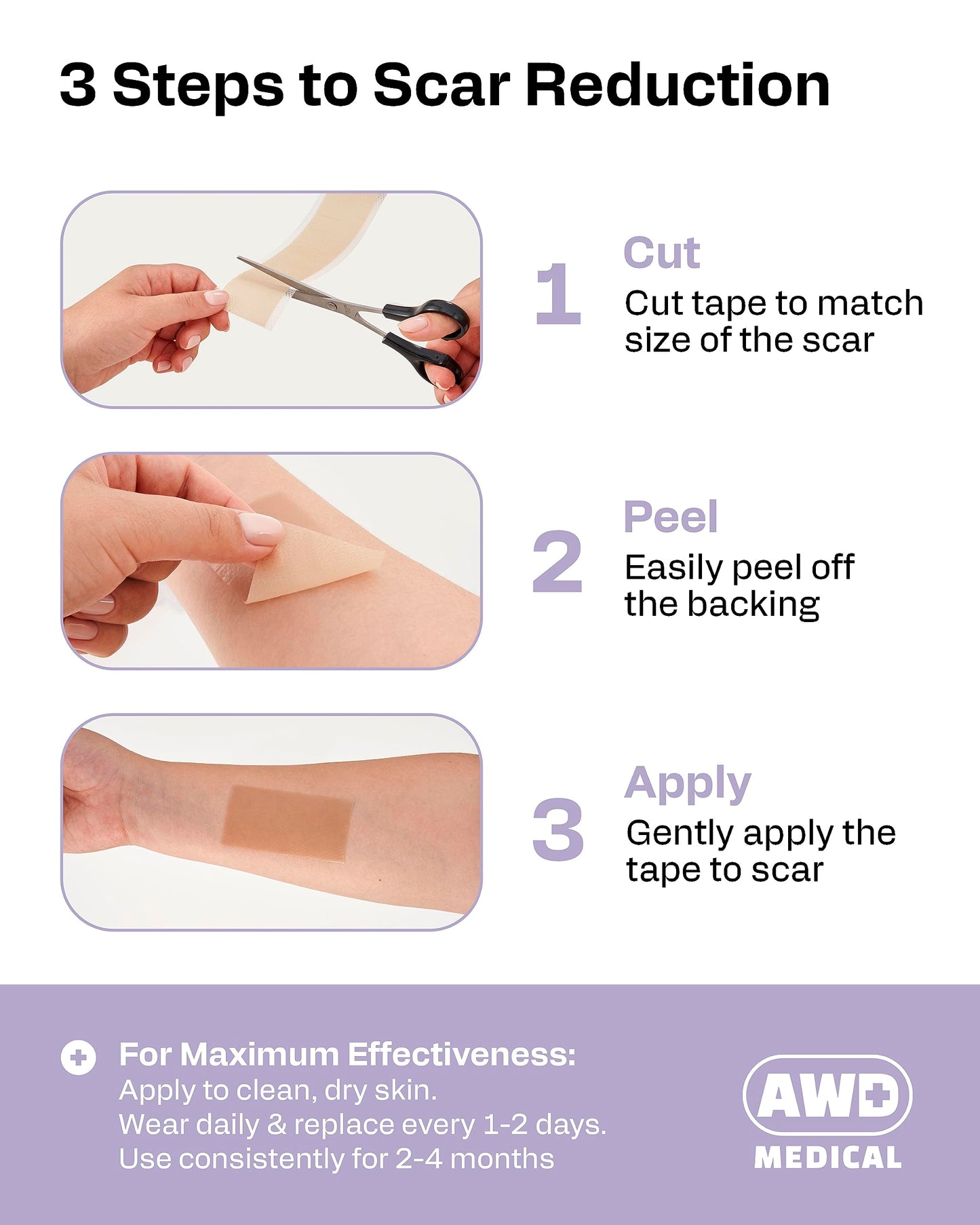 AWD Silicone Scar Tape 3 Pack – 180in Total, Reusable for Surgery & Postpartum | AWD Medical