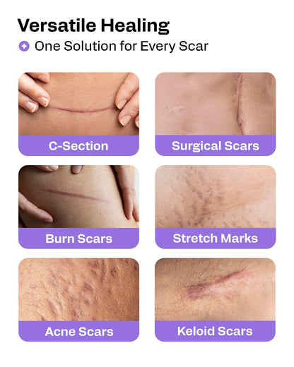 AWD Medical Silicone Scar Tape 120in Roll – Medical Grade Scar Sheets for Surgical, C-Section & Postpartum Recovery