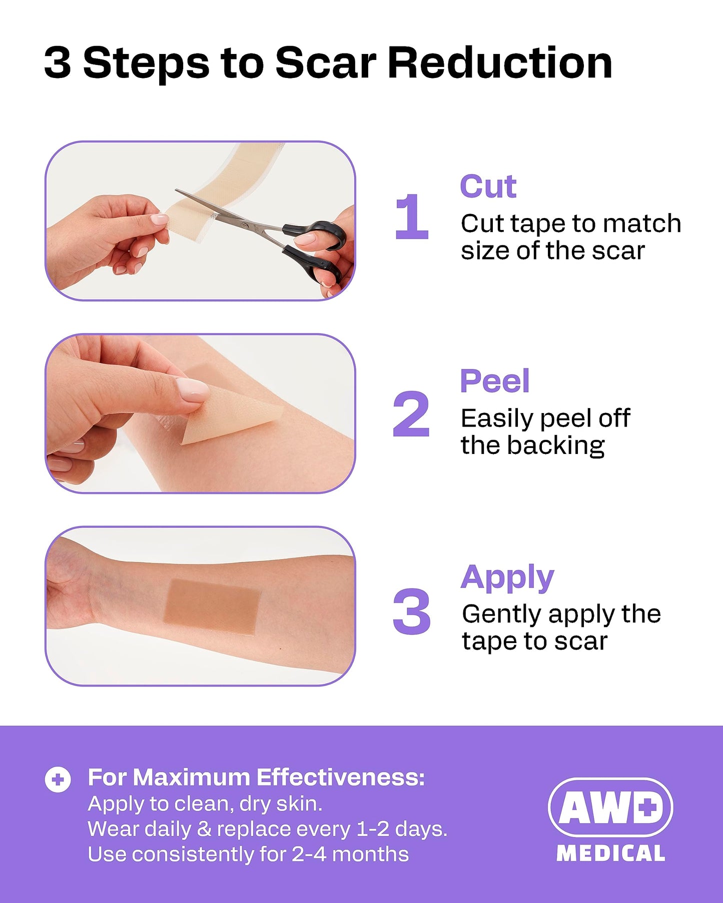 AWD Medical Silicone Scar Tape 120in Roll – Medical Grade Scar Sheets for Surgical, C-Section & Postpartum Recovery