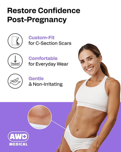 AWD Medical Silicone Scar Tape 120in Roll – Medical Grade Scar Sheets for Surgical, C-Section & Postpartum Recovery