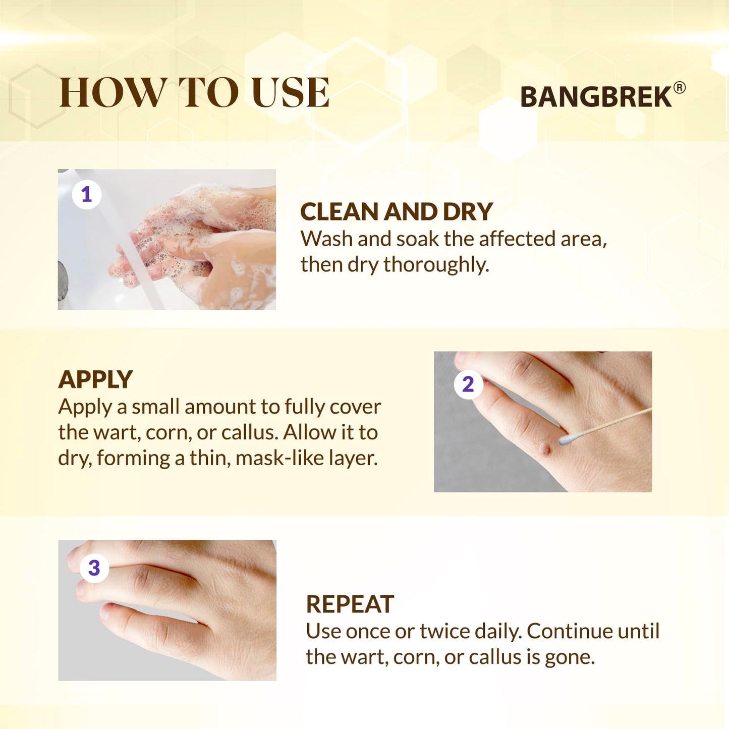 Bangbrek Bee Venom Wart Remover — 17% Salicylic Acid Fast-Acting Wart & Callus Remover (1 fl oz)