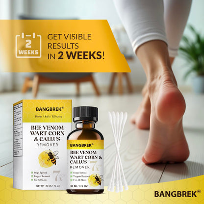 Bangbrek Bee Venom Wart Remover — 17% Salicylic Acid Fast-Acting Wart & Callus Remover (1 fl oz)