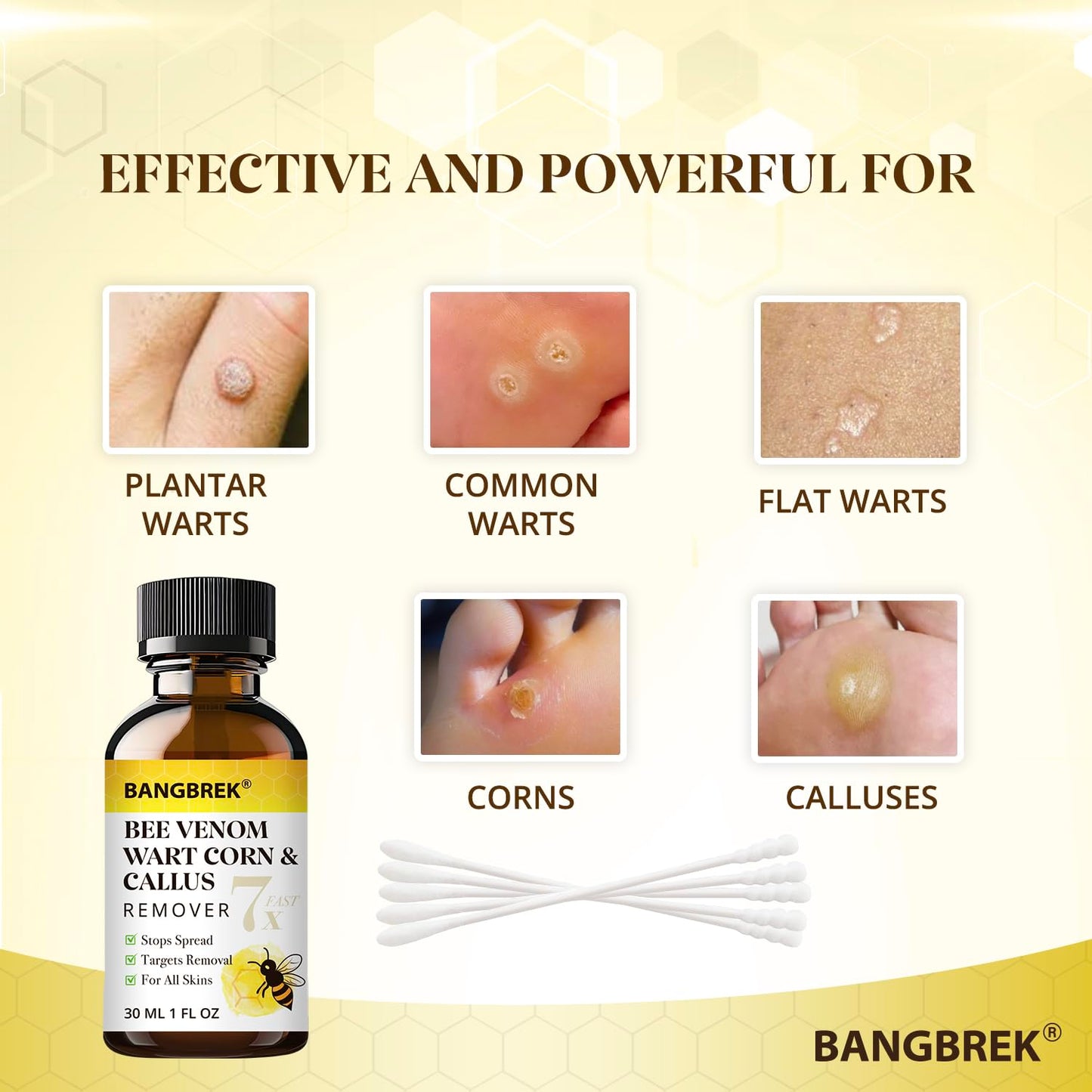 Bangbrek Bee Venom Wart Remover — 17% Salicylic Acid Fast-Acting Wart & Callus Remover (1 fl oz)